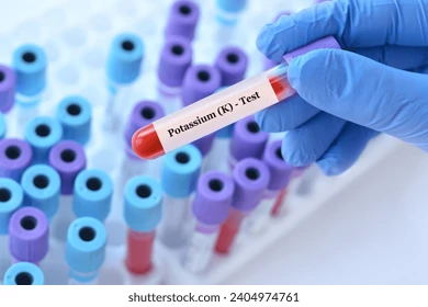 পটাসিয়াম পারম্যাঙ্গনেটের ব্যবহার কী কী? 